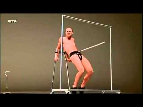 When you Google images for "person with crutches," this is one that shows up. Enjoy.